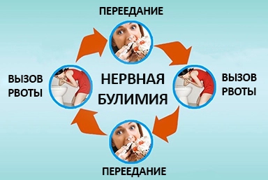 Лечение булимии в Черемхово